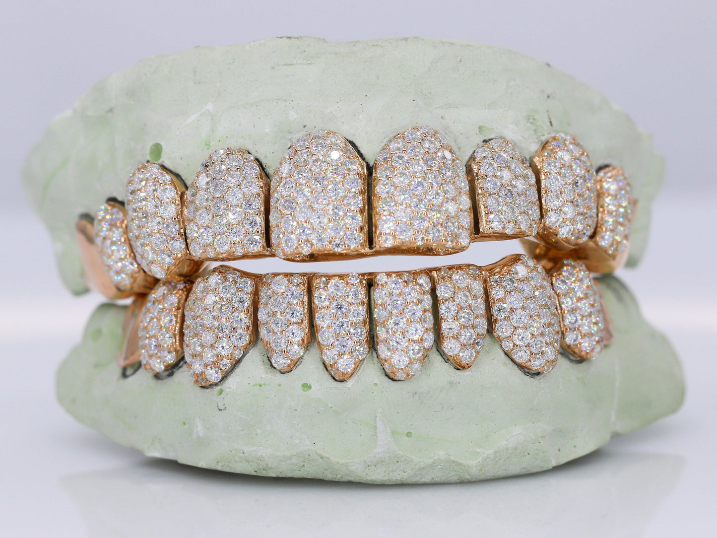 10 on 10 Capped VVS Moissanite Diamond Grillz