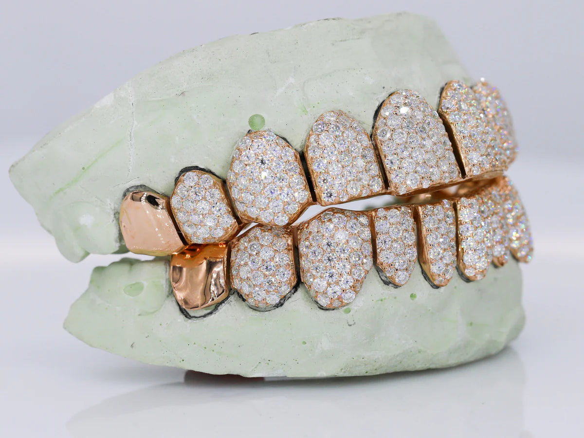 10 on 10 Capped VVS Moissanite Diamond Grillz