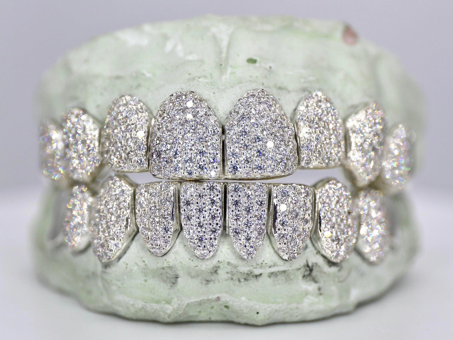 10 on 10 Capped VVS Moissanite Diamond Grillz
