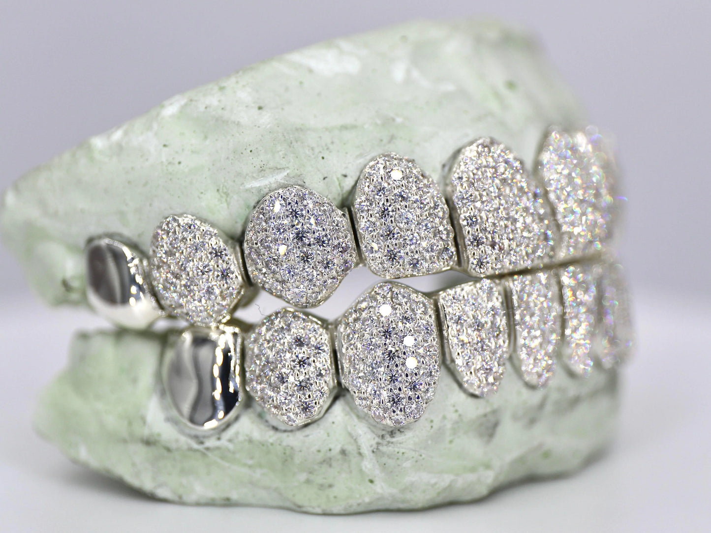 10 on 10 Capped VVS Moissanite Diamond Grillz