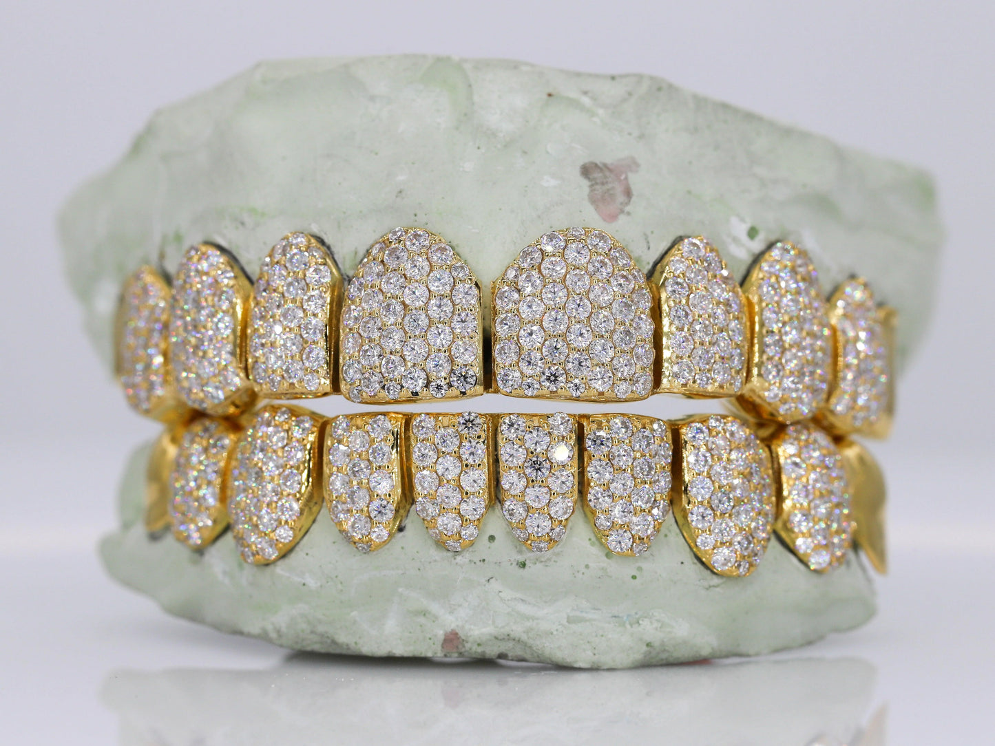 10 on 10 Capped VVS Moissanite Diamond Grillz