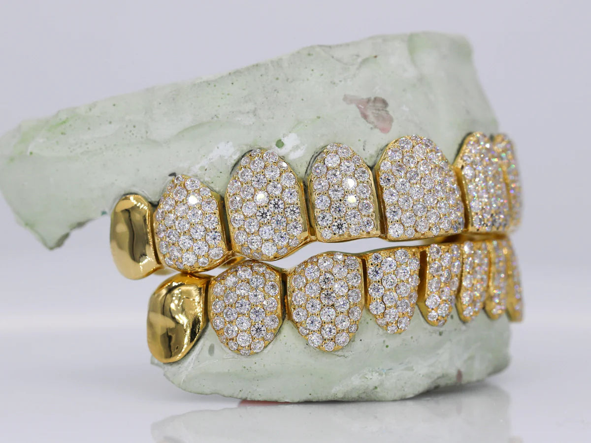 10 on 10 Capped VVS Moissanite Diamond Grillz