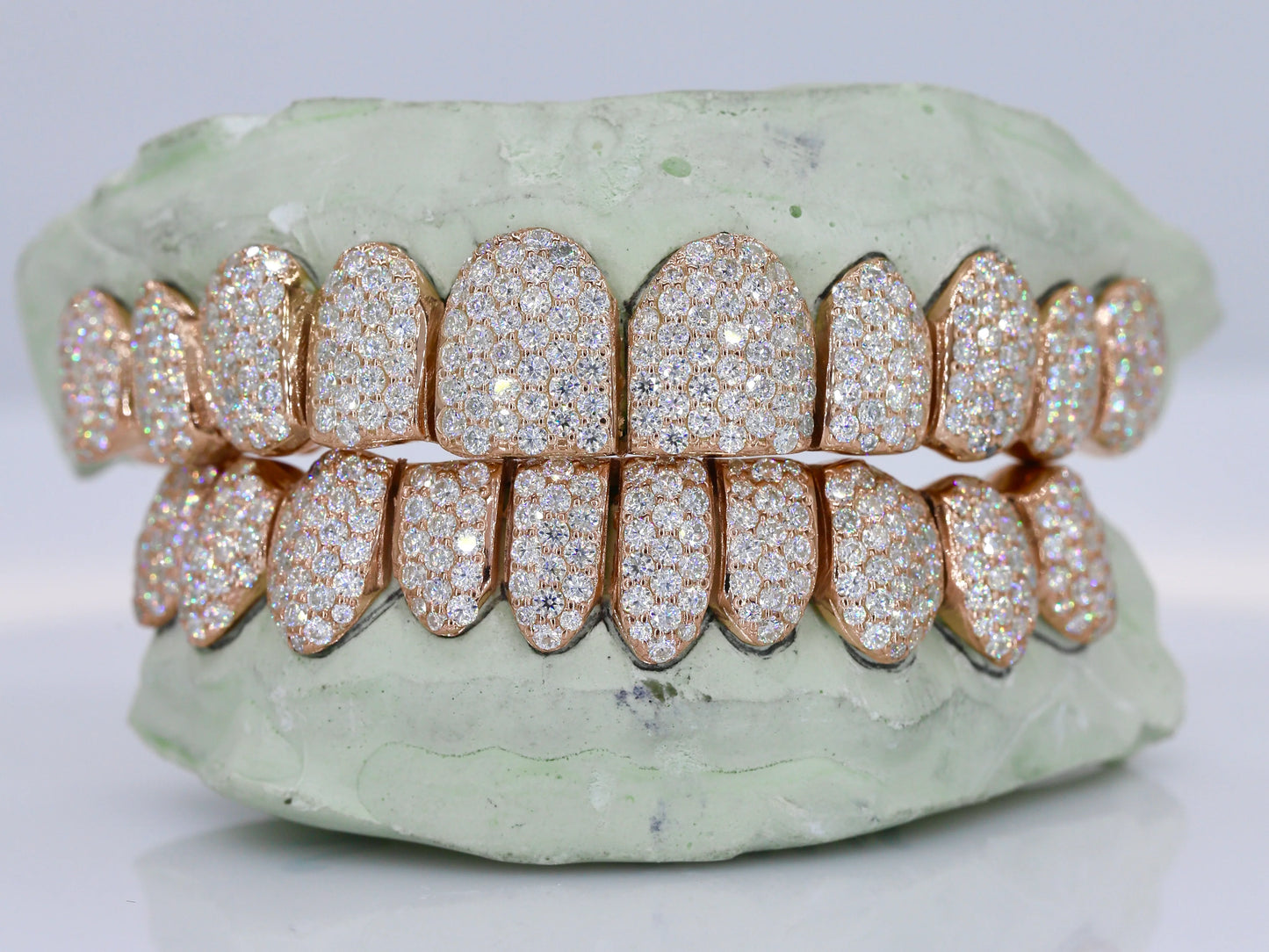 10 on 10 VVS Moissanite Diamond Grillz