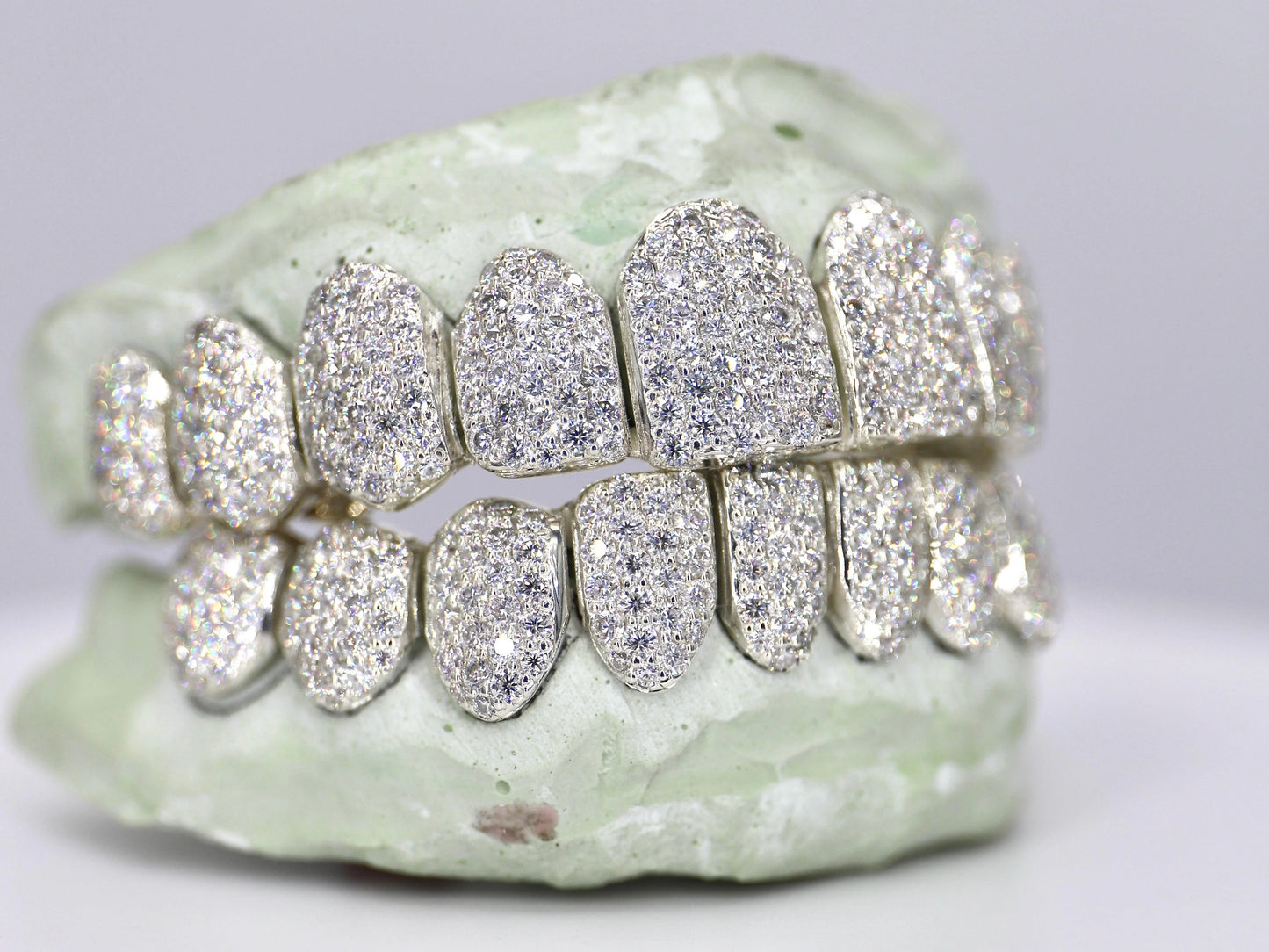 10 on 10 VVS Moissanite Diamond Grillz