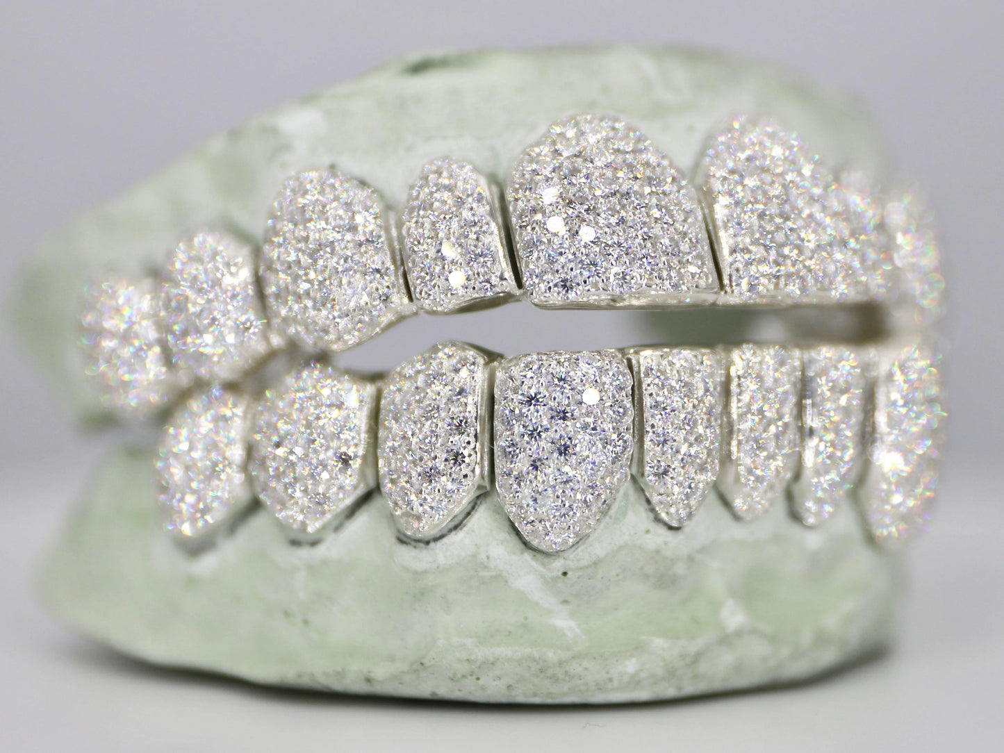 10 on 10 VVS Moissanite Diamond Grillz