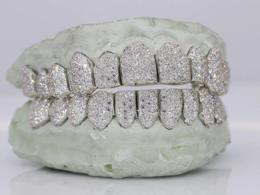 12 on 12 VVS Moissanite Diamond Grillz