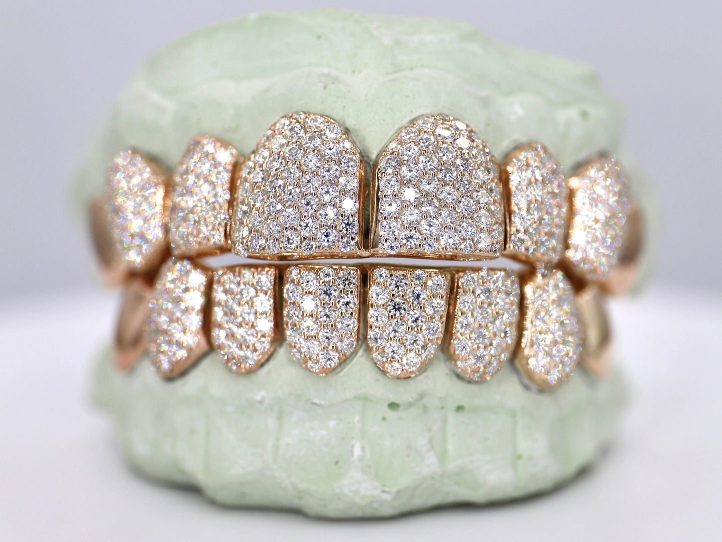8 on 8 Capped VVS Moissanite Diamond Grillz