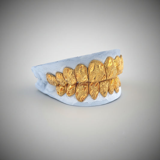 Dust Nugget Grillz