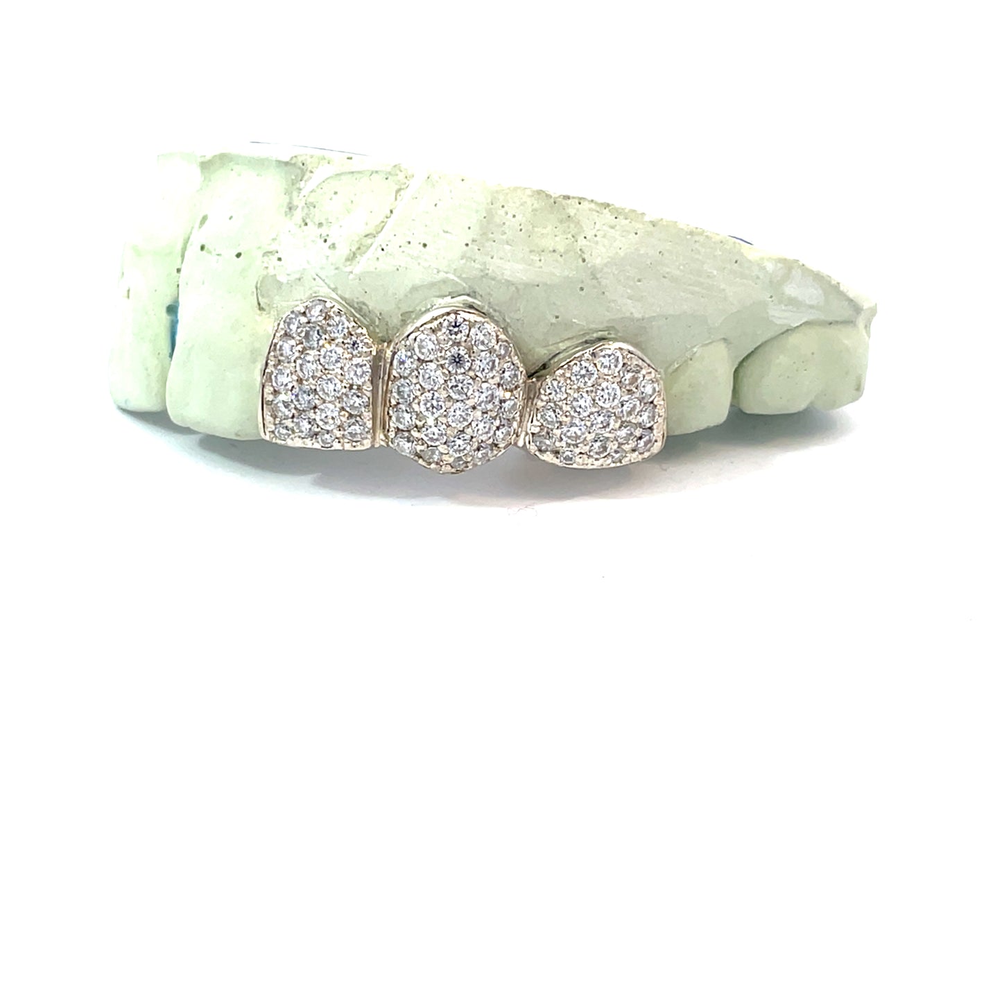 3-Piece VVS Moissanite Diamond Grillz