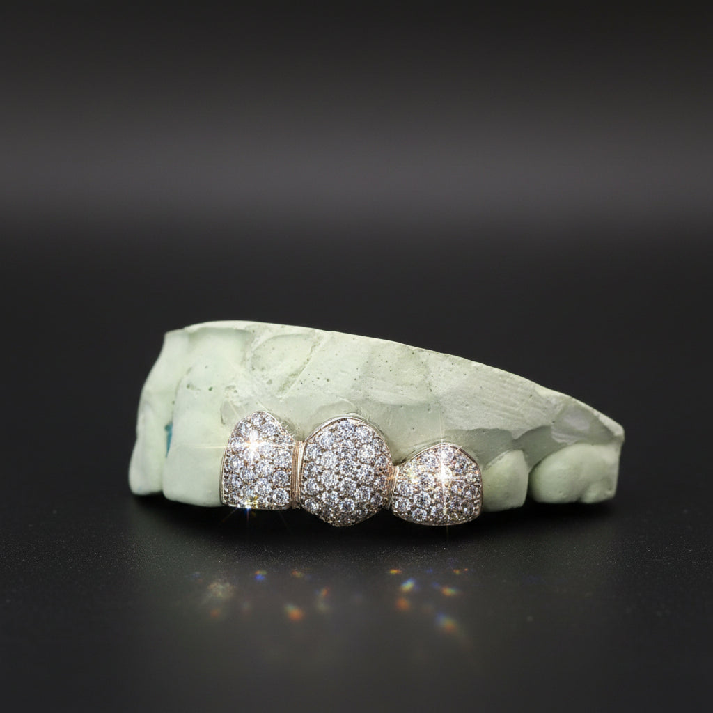 3-Piece VVS Moissanite Diamond Grillz