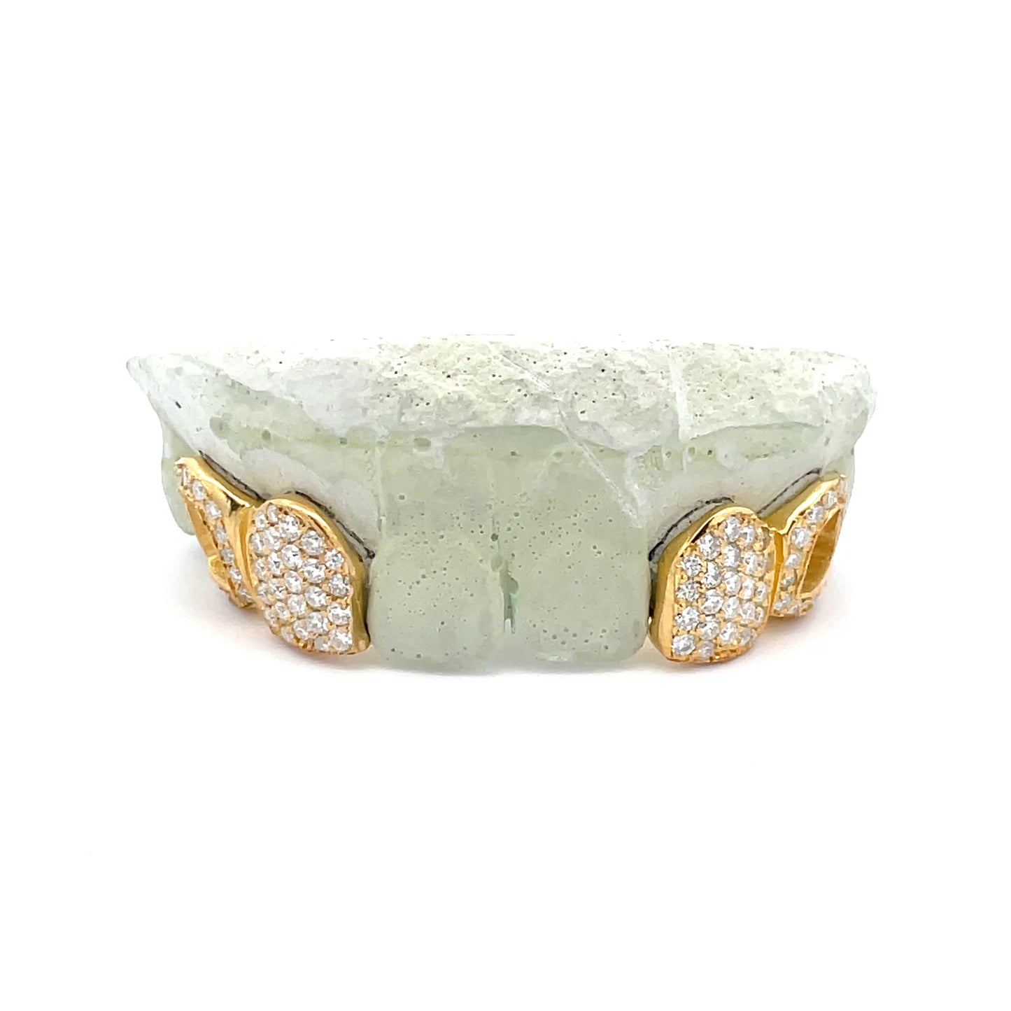 2-Piece - 1 Fully Flooded/1 Open Face VVS Moissanite Diamond Grillz