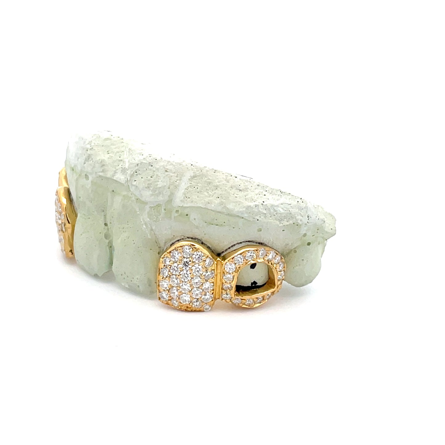 2-Piece - 1 Fully Flooded/1 Open Face VVS Moissanite Diamond Grillz