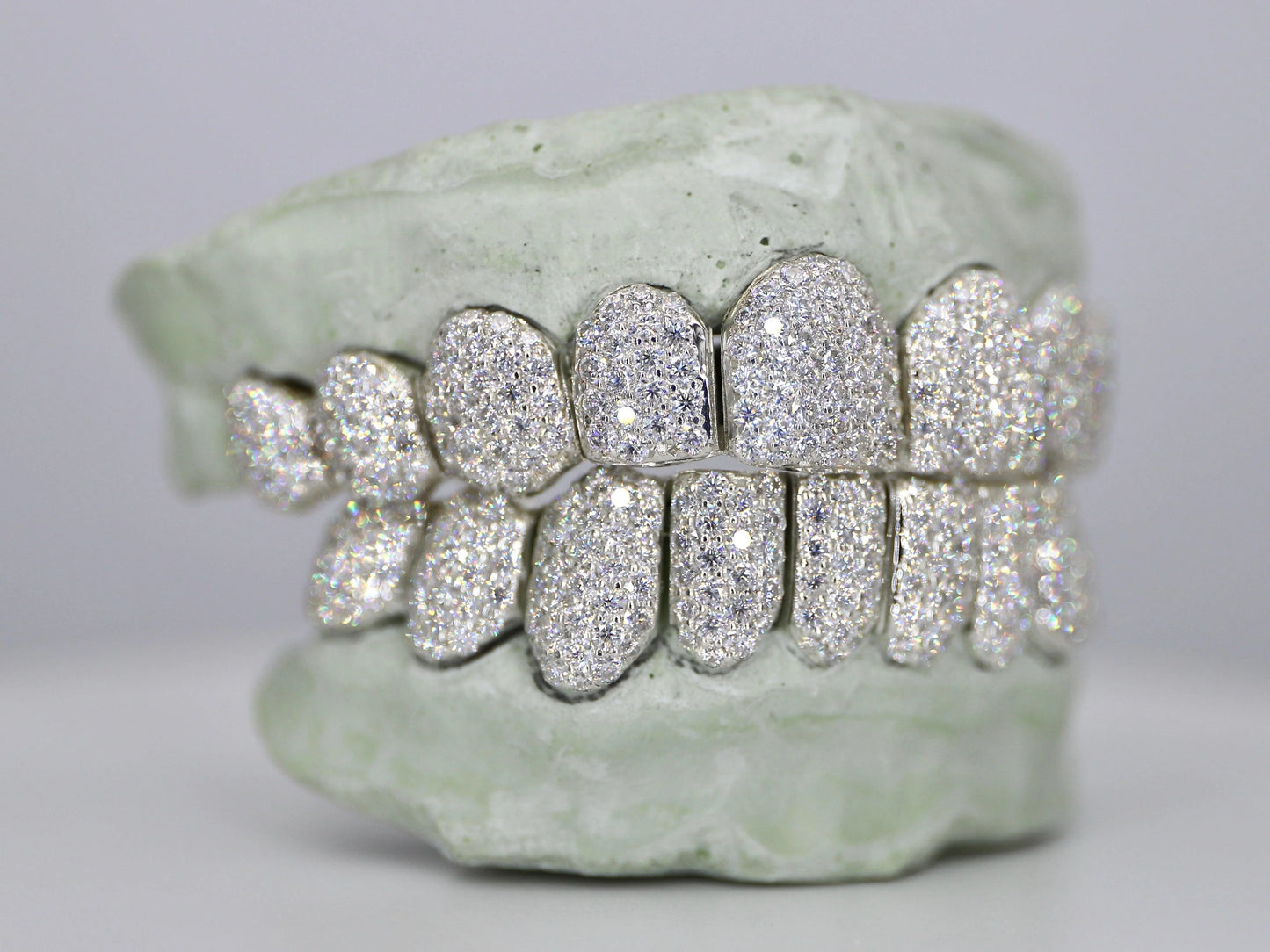 Custom VVS Moissanite Diamond Grillz