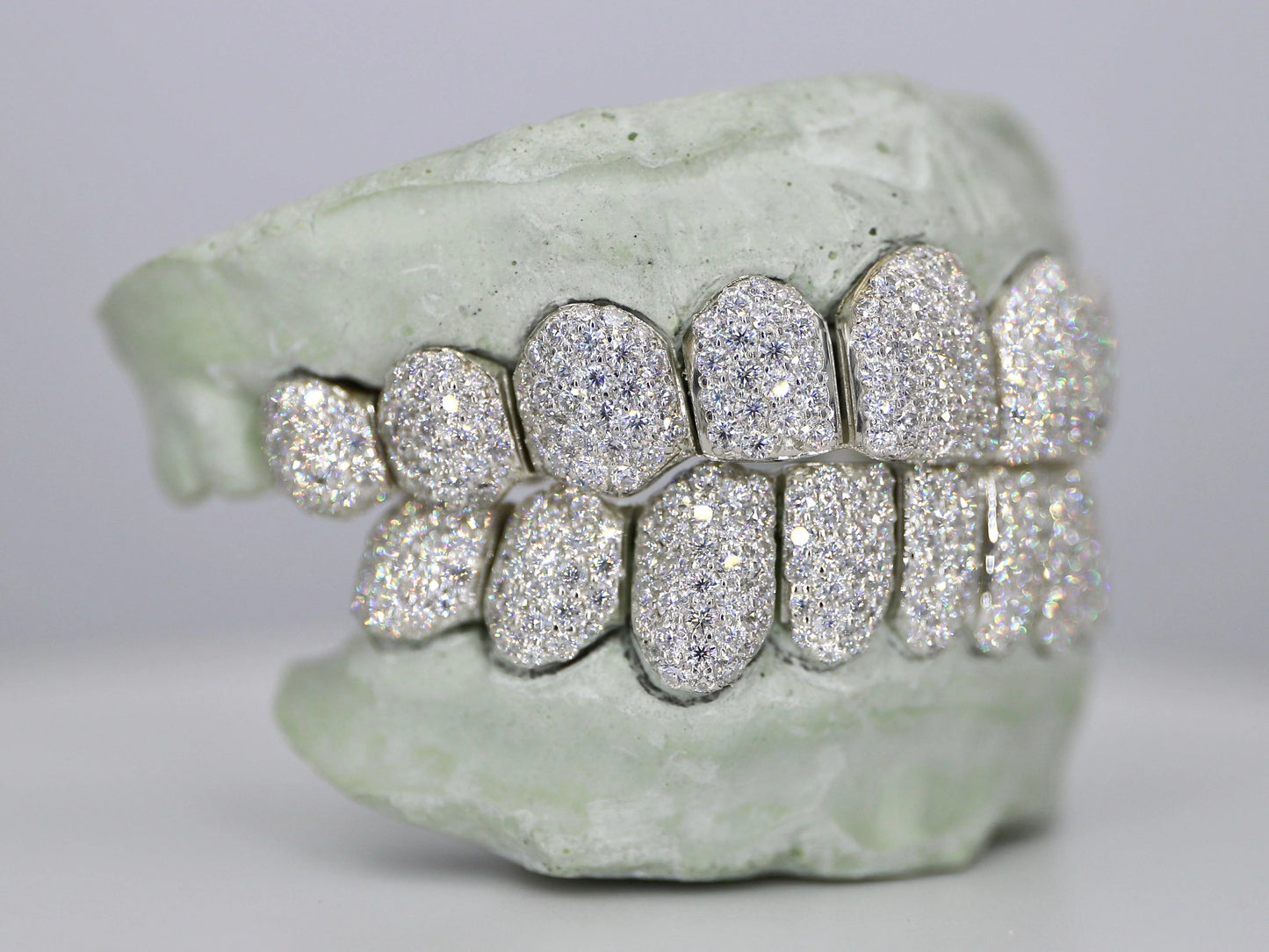 Custom VVS Moissanite Diamond Grillz