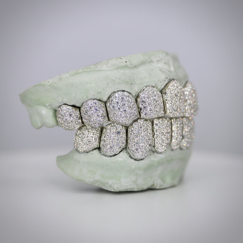 Custom VVS Moissanite Diamond Grillz