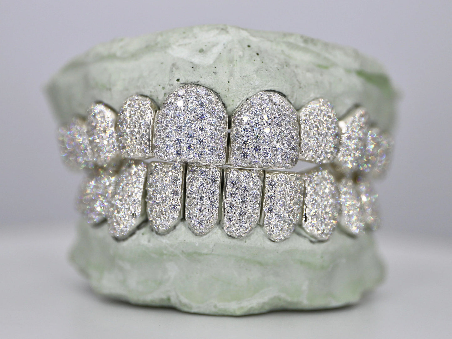 Custom VVS Moissanite Diamond Grillz