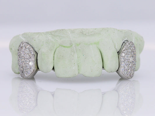 Custom Fangs VVS Moissanite Grillz