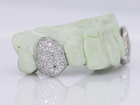 Custom Fangs VVS Moissanite Grillz