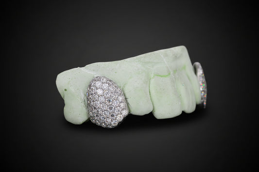 Custom Fangs VVS Moissanite Grillz