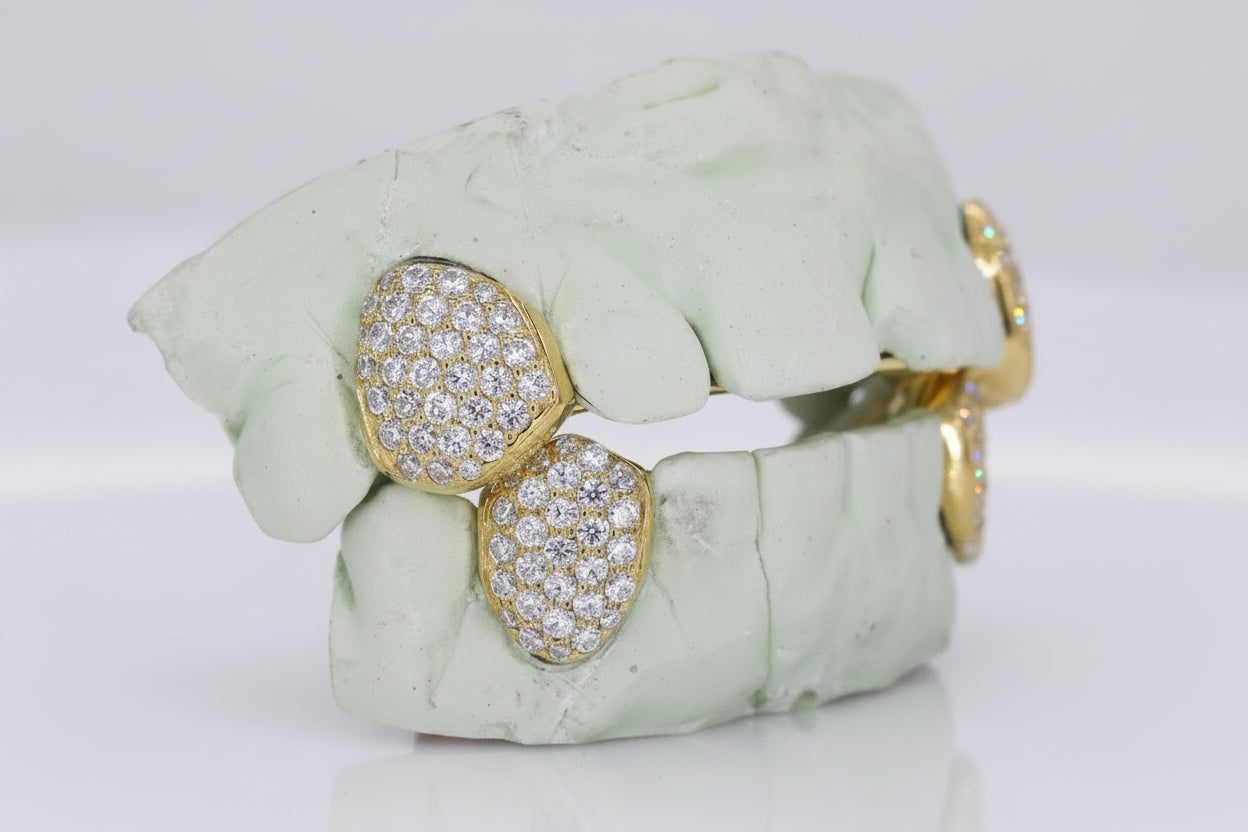 Custom Fangs VVS Moissanite Grillz