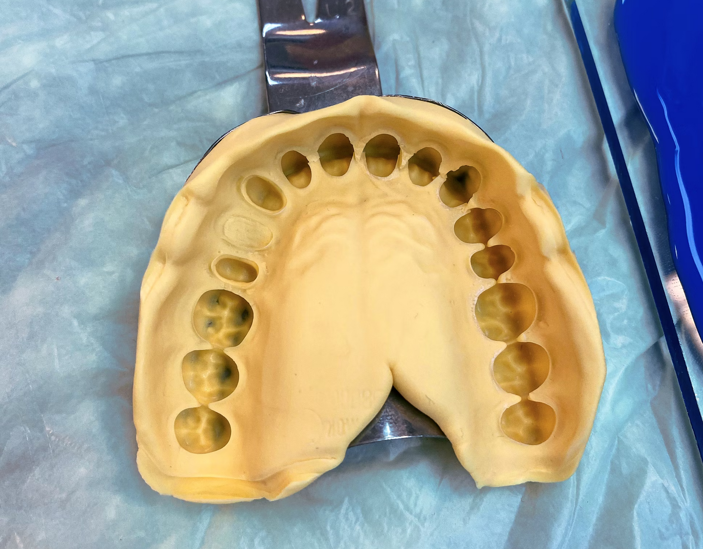Molding Kits