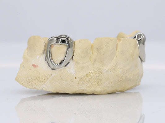 Custom Open Face Fangs Grillz