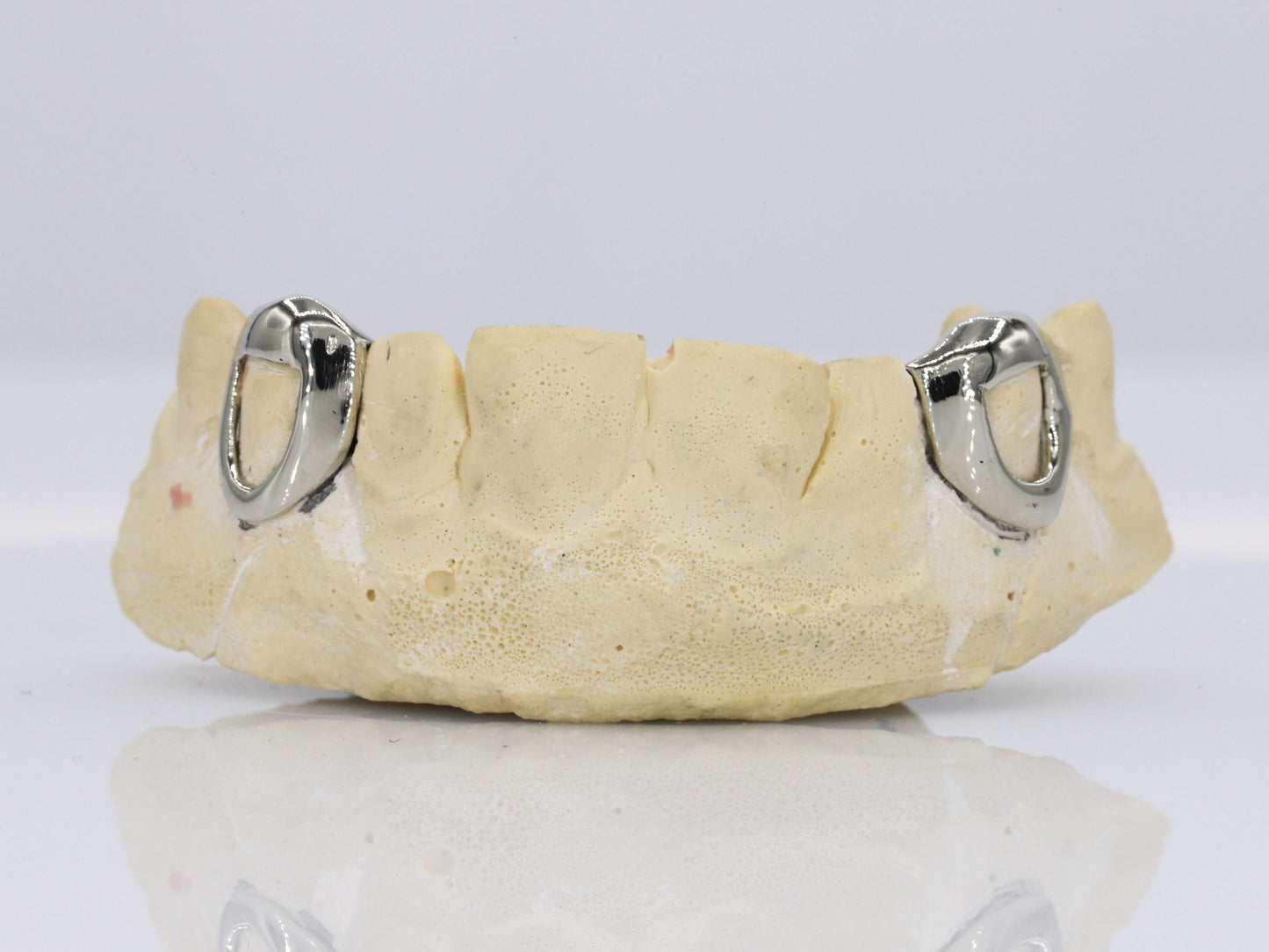 Custom Open Face Fangs Grillz