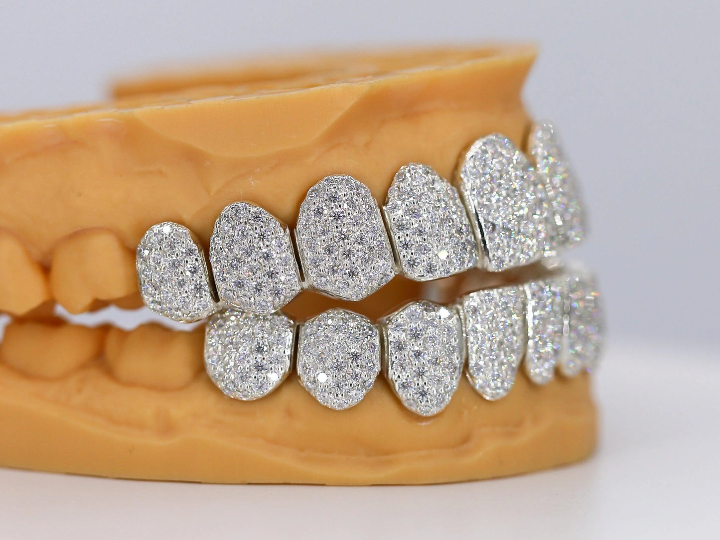 Custom Permanent VVS Moissanite Grillz
