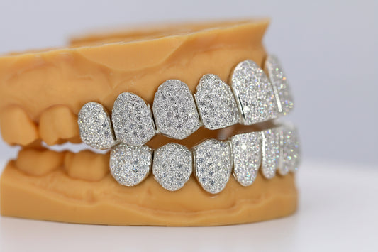 Custom Permanent VVS Moissanite Grillz