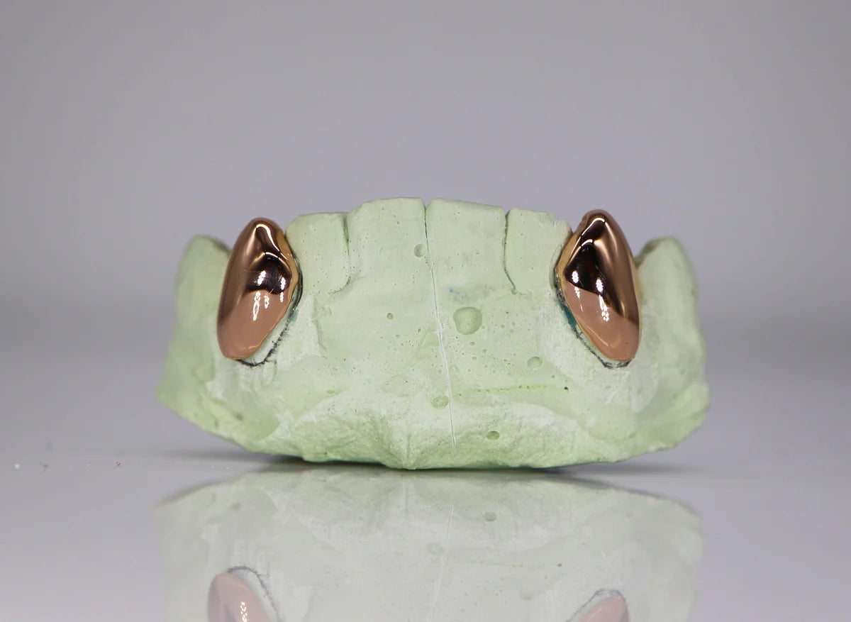 Custom Gold Fangs Grillz