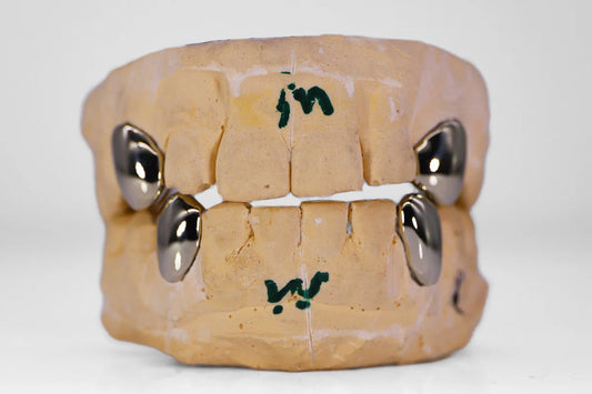 Custom Gold Fangs Grillz