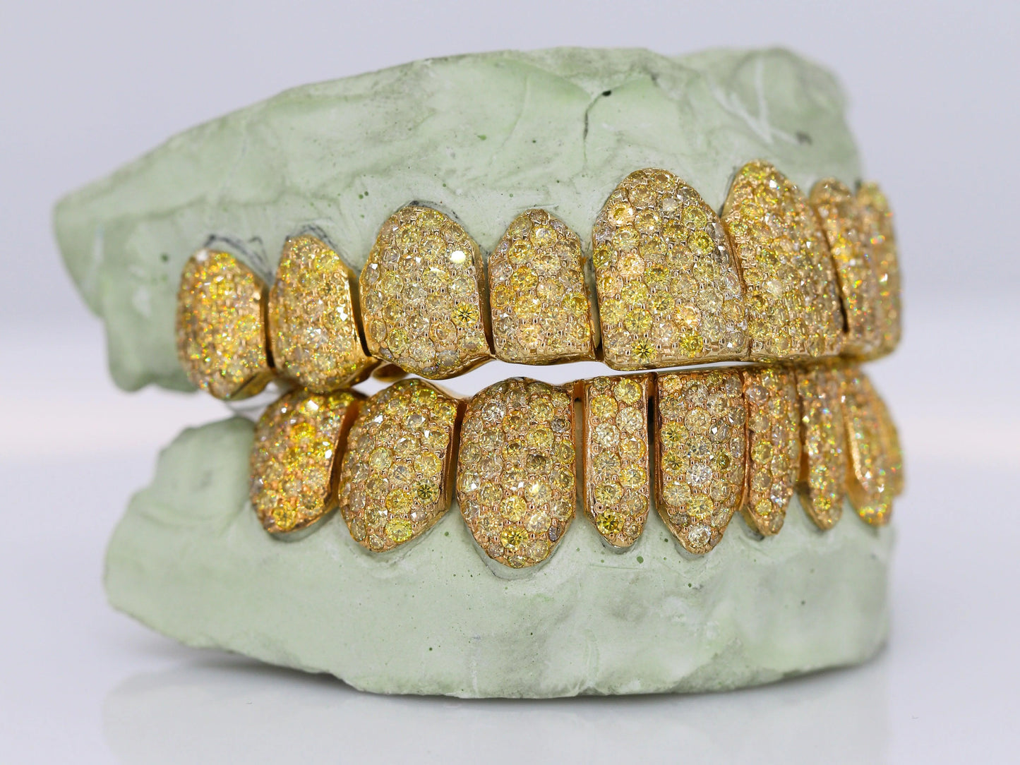 Yellow Canary VVS Moissanite Diamond Grillz