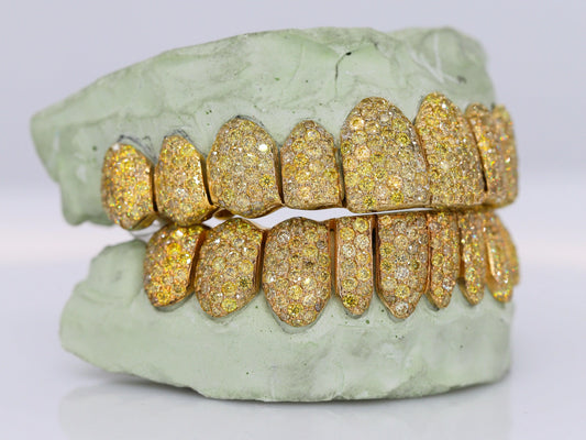 Yellow Canary VVS Moissanite Diamond Grillz