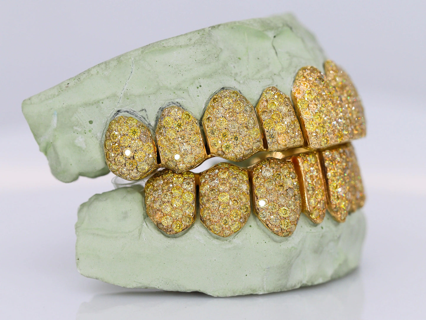 Yellow Canary VVS Moissanite Diamond Grillz