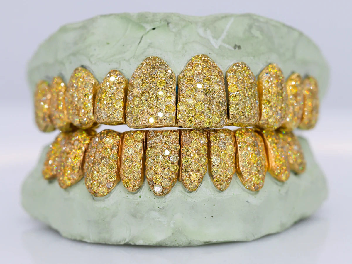 Yellow Canary VVS Moissanite Diamond Grillz