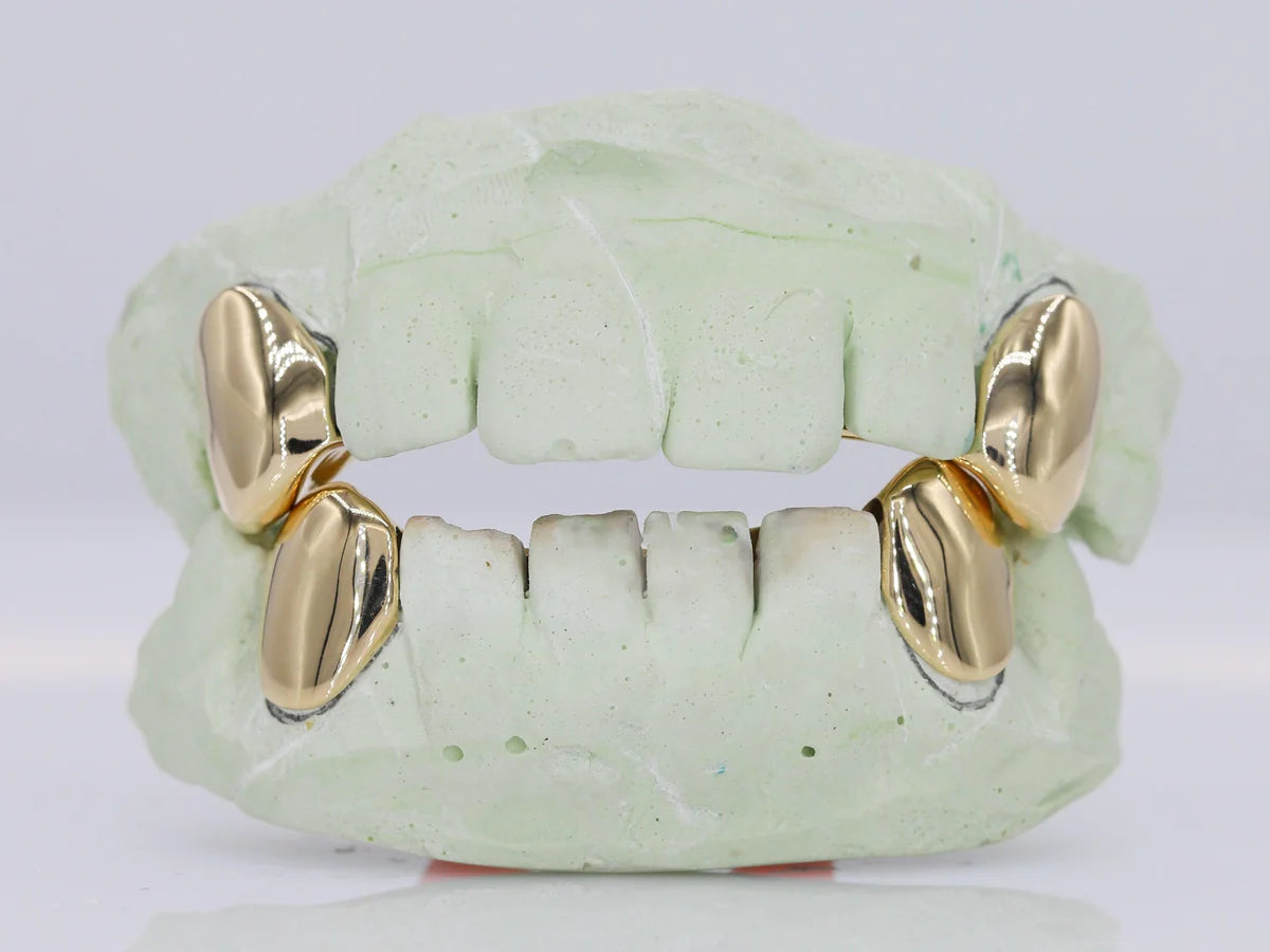 Custom Gold Fangs Grillz
