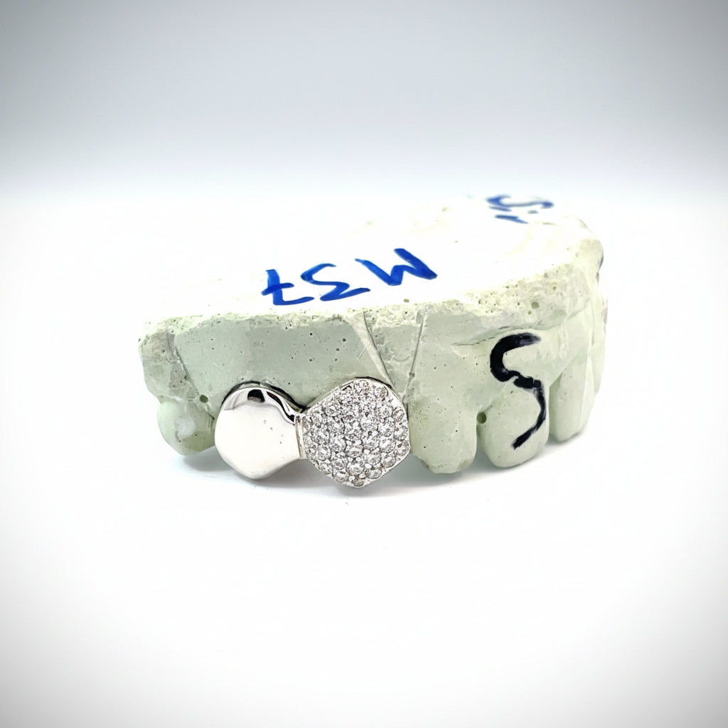 Dub Cap 1 Solid/1 VVS Moissanite Diamond Grillz